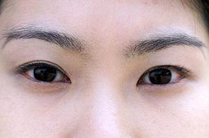 βグルカン製品で見過ごされていた事